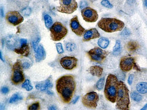 IHC of Growth Hormone on a FFPE Pituitary Tissue